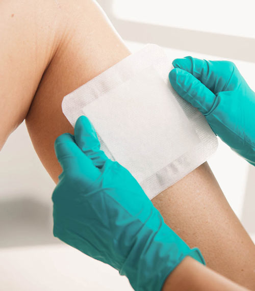 انواع پانسمان خشک و مرطوب