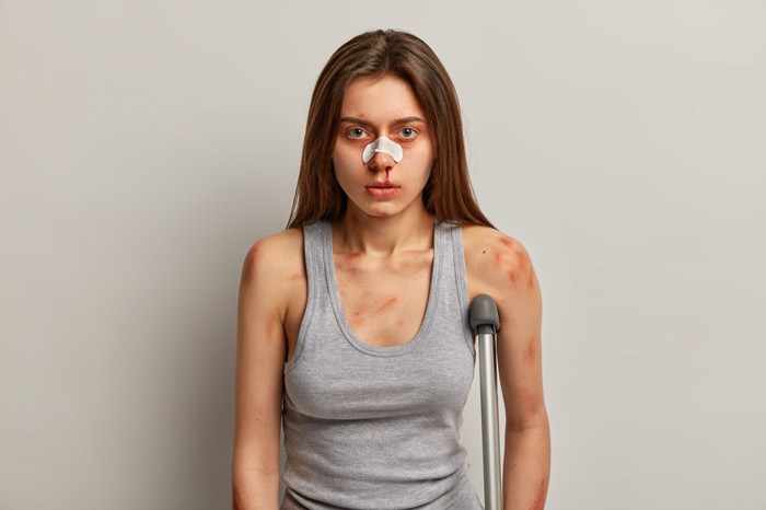 زخم تروماتیک