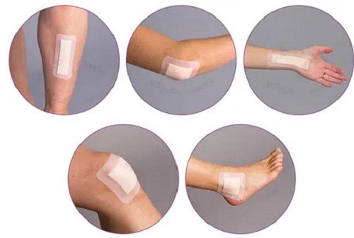 پانسمان مرطوب چیست؟