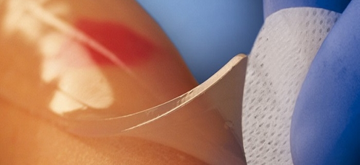 پانسمان مرطوب چیست؟