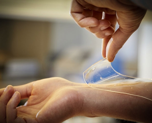 پانسمان هیدروژن : راه‌حل نوین در درمان زخم‌ها