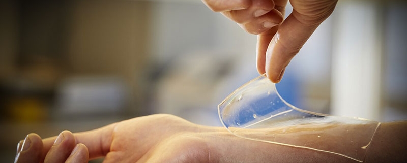 پانسمان هیدروژن : راهحل نوین در درمان زخمها