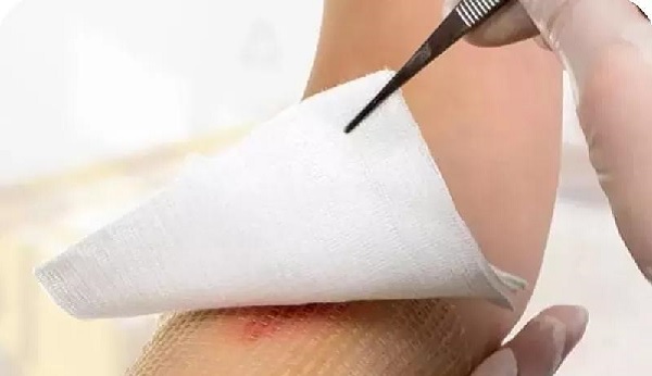 پانسمان مرطوب چیست؟