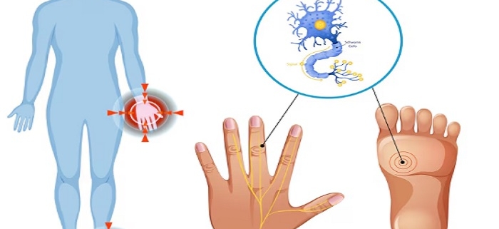 زخم‌های نوروپاتیک