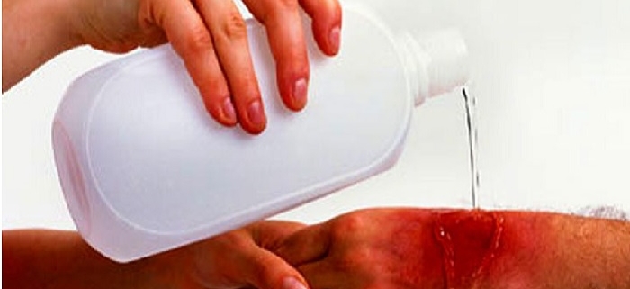 شستشوی زخم در خانه