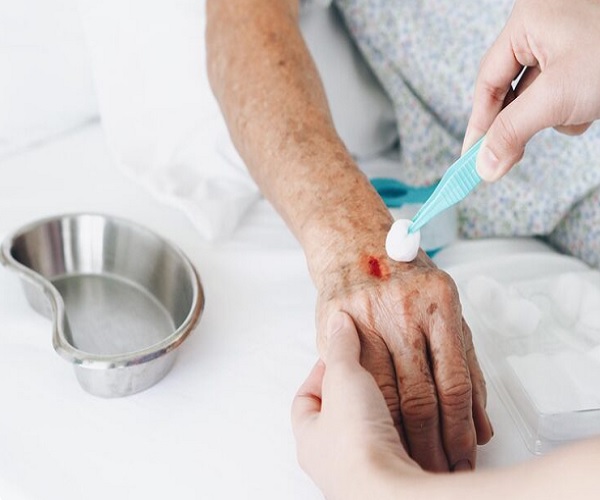 شستشوی زخم در خانه
