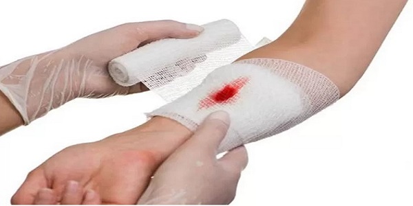 مراقبت اولیه از بمباران زخم