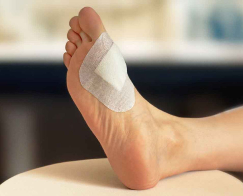 پانسمان آنتی باکتریال یا ضد باکتری