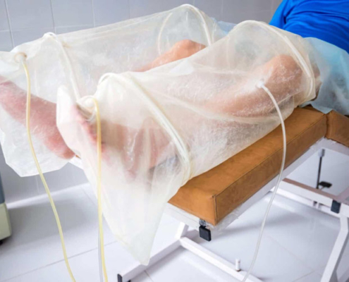 اوزون تراپی زخم در کرج